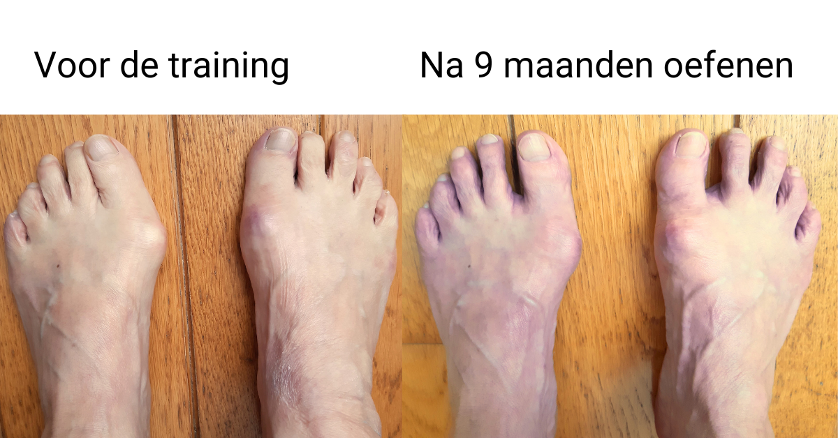 resultaten van voetentraining.nl, een afbeelding waarbij succes is bereikt met de voententraining cursus een goede ervaring